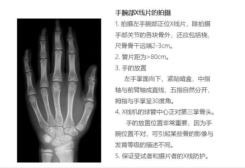 手腕部拍摄标准.png